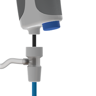 AmnioFix wird in der Kanüle platziert.